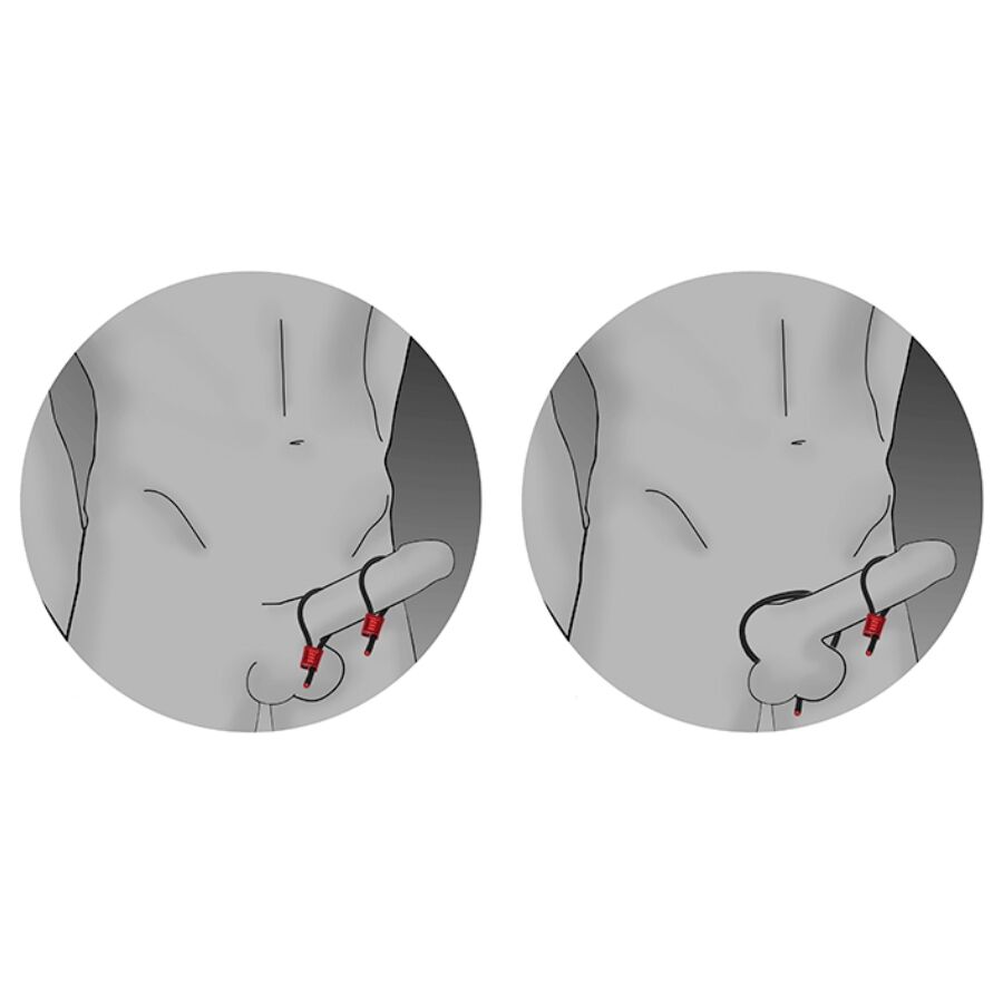 ElectraLoops Prestige Neri — ElectraStim